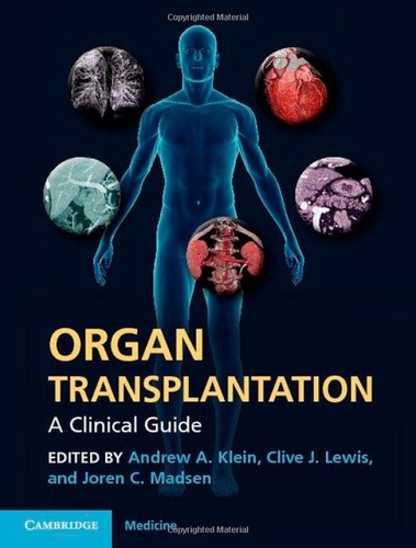 Organ transplantation